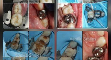 WhatsApp Image 2022-02-28 at 11.58.22 AM WhatsApp Image 2022-02-28 at 11.58.22 AM