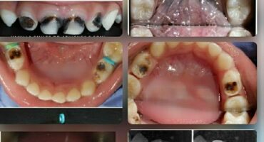 WhatsApp Image 2022-02-28 at 12.31.06 PM WhatsApp Image 2022-02-28 at 12.31.06 PM