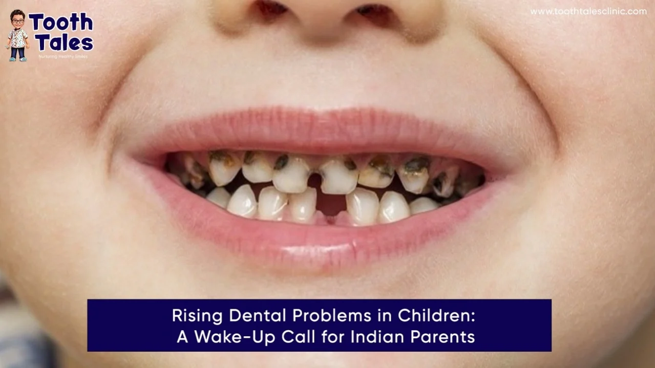 Rising Dental Problems in Children: A Wake-Up Call for Indian Parents